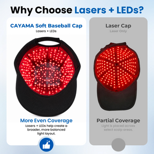 CAYAMA C06 Advanced Laser Hair Growth Cap-320 Light Sources