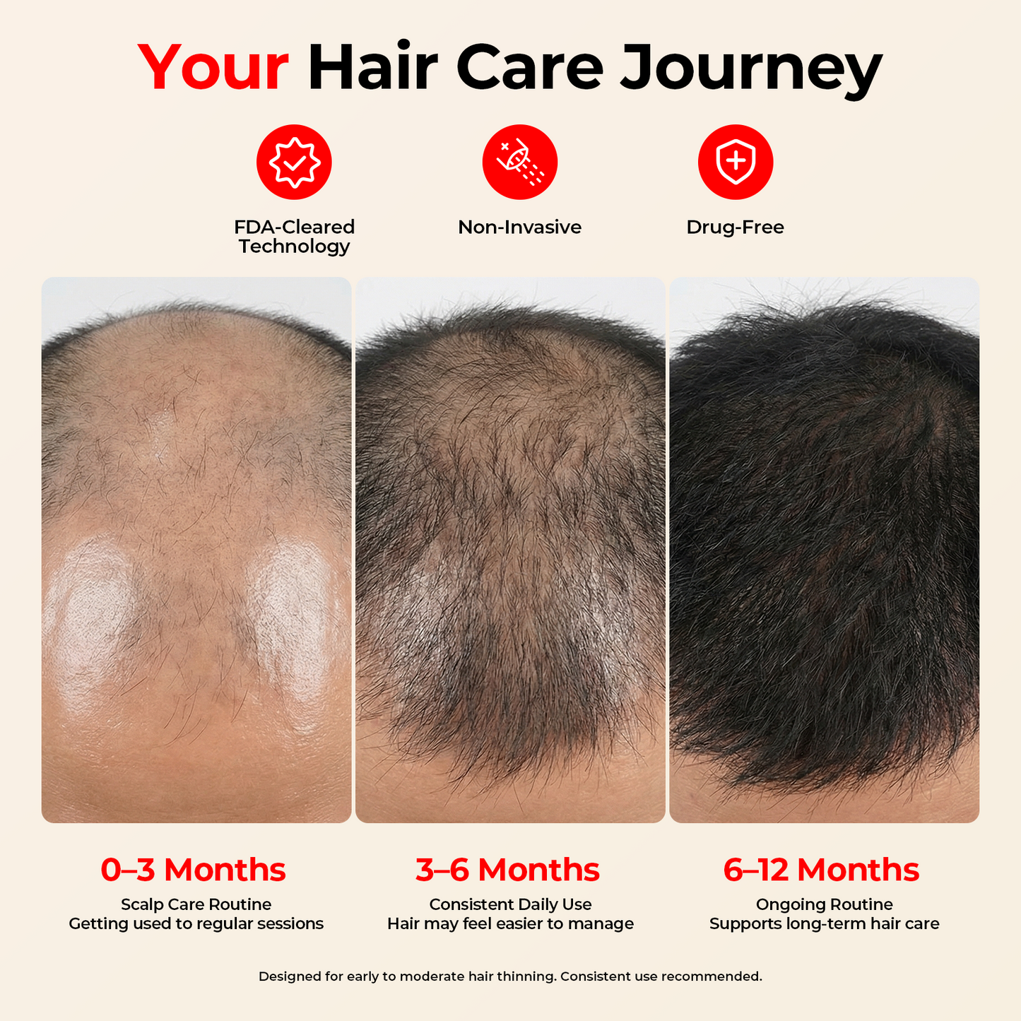 CAYAMA Red Light Hair Growth Cap – Full-Scalp Coverage for Men & Women