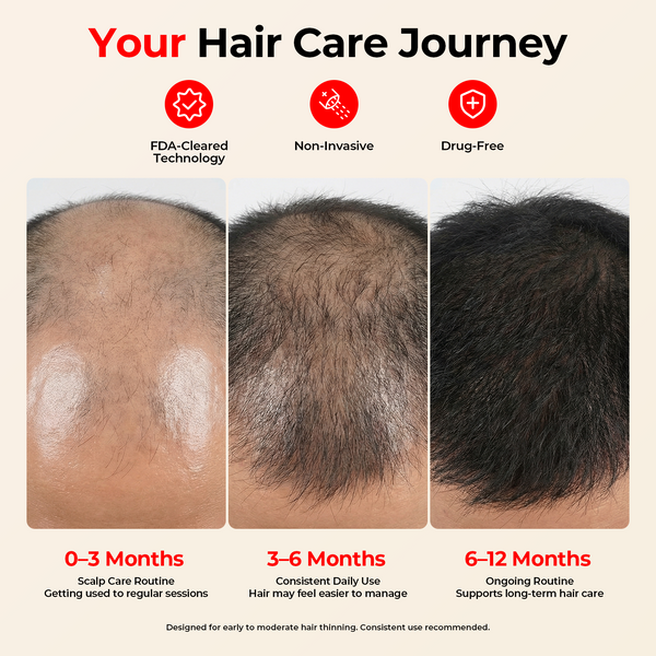 CAYAMA C01 Red Light Hair Growth Cap