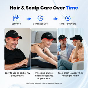 CAYAMA C03 Portable Wireless-Controlled Red Light Hair Growth Cap