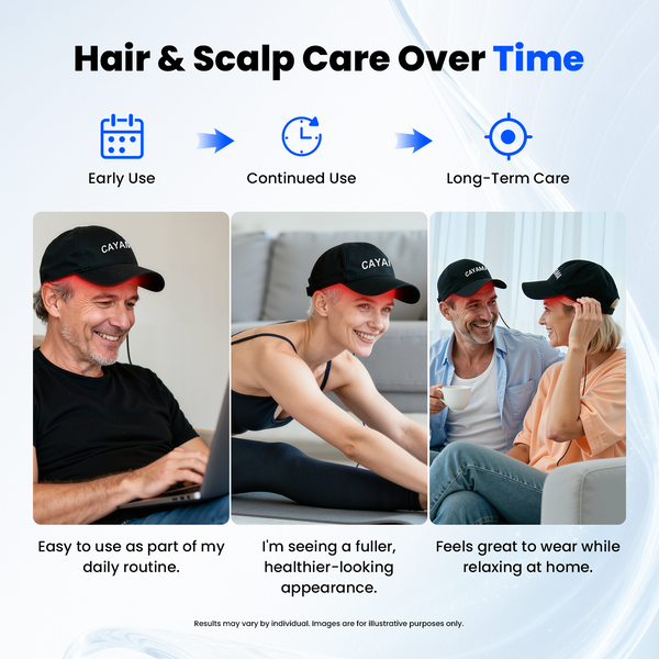 CAYAMA C03 Portable Wireless-Controlled Red Light Hair Growth Cap