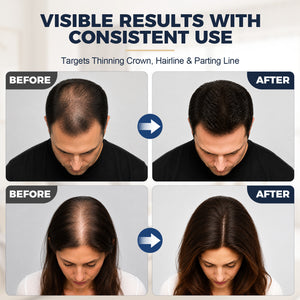 CAYAMA C07 Portable True Wireless Red Light Hair Growth Cap