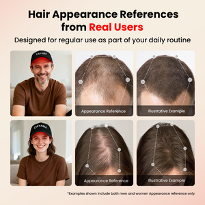 CAYAMA C08 Wired Red Light Hair Growth Cap