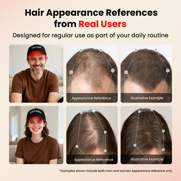 CAYAMA C08 Wired Red Light Hair Growth Cap