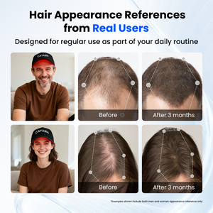 CAYAMA C03 Portable Wireless-Controlled Red Light Hair Growth Cap