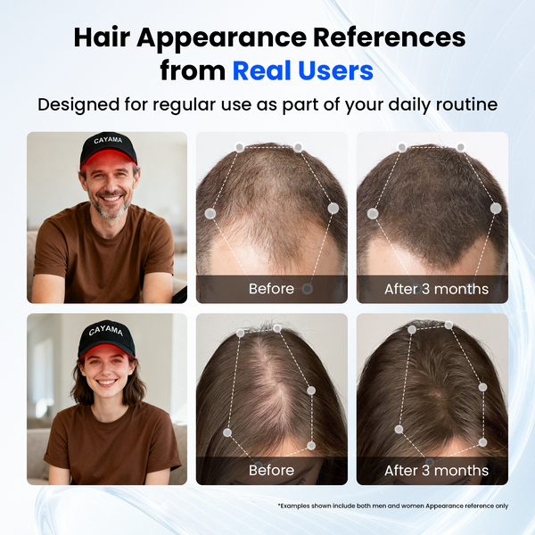 CAYAMA C03 Portable Wireless-Controlled Red Light Hair Growth Cap